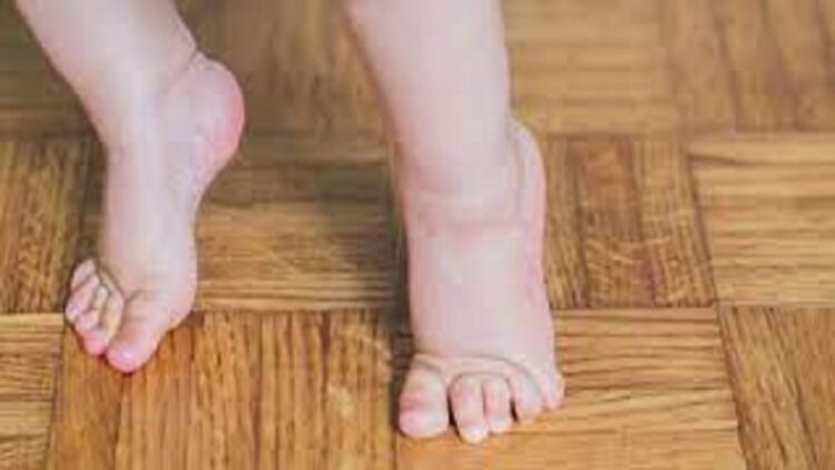 Jangan Abaikan! Anak Suka Jalan Jinjit, Bisa Jadi Ini Penyebabnya 1 ilustrasi anak berjalan jinjit