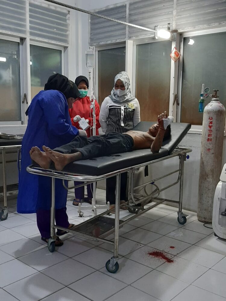 Duh! Pelaku Pencurian di Kuranji Kota Padang Babak Belur Dihajar Massa, Jari Putus 1 Pelaku pencurian menjadi bulan-bulanan warga usai ketahuan mencuri.
(IST)