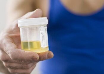Kenali Tiap Makna Urine dari Warnanya, Bisa Jelaskan Kondisi Kesehatan Anda