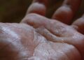 Tangan Berkeringat? Ini Pertanda Kondisi Medis Menurut Dokter