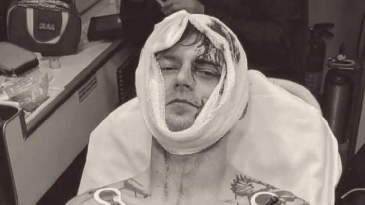 Petarung MMA Hunter Boone mengalami cedera kepala parah. (Sumber : Instagram alphawolfboone)