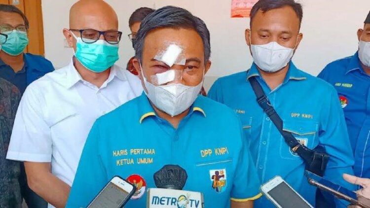 Ketua Umum Dewan Pengurus Pusat (DPP) Komite Nasional Pemuda Indonesia (KNPI), Haris Pertama. (net)