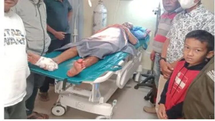 Warga Pasbar Digigit Buaya saat Ambil Wudhu, Punggung dan Kaki Terluka 1 Seorang warga Rantau Panjang Kecamatan Sasak Kabupaten Pasaman Barat, Sumatera Barat Sejet (46) digigit buaya Minggu (27/3/2022) malam dan mendapatkan perawatan intensif di RSUD, Senin (28/3/2022). (ANTARA/Altas Maulana)