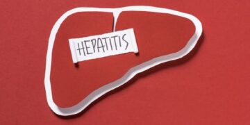 Seberapa Menularnya Hepatitis Akut? Begini Penjelasan Dokter 8 Seberapa Menularnya Hepatitis Akut? Begini Penjelasan Dokter