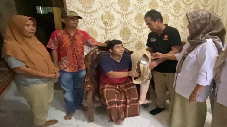 Bantuan kaki palsu dari Andre Rosiade.
