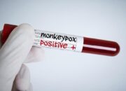 Kasus Cacar Monyet Belum Ditemukan di Indonesia