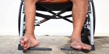 Tanpa Gejala, 3 Anak di Aceh Positif Polio 8 Tanpa Gejala, 3 Anak di Aceh Positif Polio