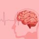 ilustrasi penyakit stroke