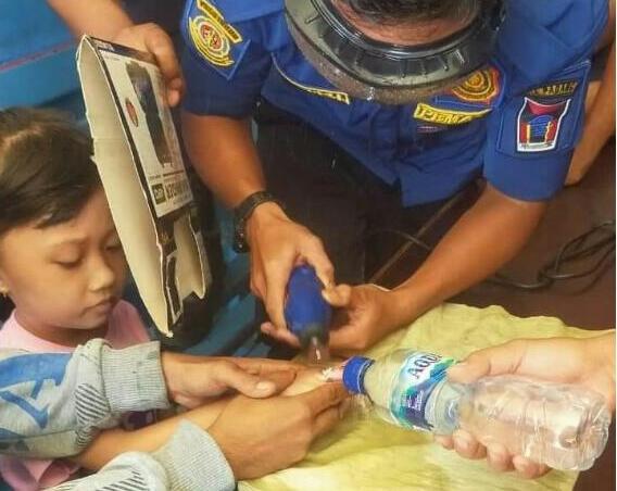 Sulit Dilepaskan, Damkar Padang Potong Cincin di Jari Bocah di Padang 1 Petugas Damkar Padang melepaskan cincin yang tersangkut di jari seorang bocah di Padang. (Foto: radarsumbar.com/Istimewa)