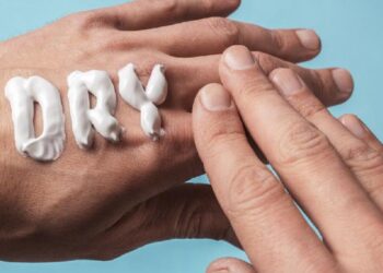 ilustrasi kulit kering. (Dok. istimewa)