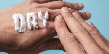 ilustrasi kulit kering. (Dok. istimewa)