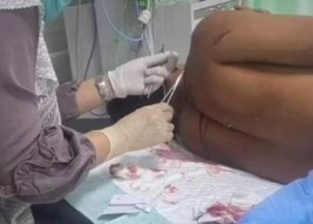 Salah seorang korban pembacokan saat menjalani perawatan. (Dok. Istimewa)