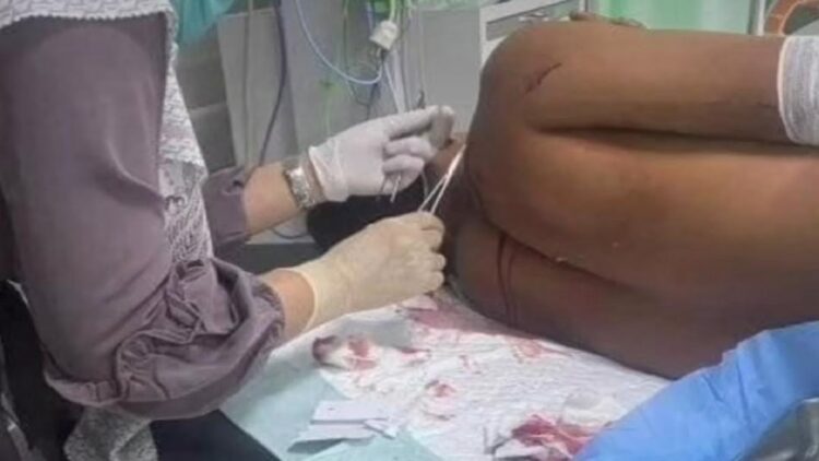 Diduga Tawuran, Dua Pelajar di Padang Pariaman Dibacok 1 Salah seorang korban pembacokan saat menjalani perawatan. (Dok. Istimewa)