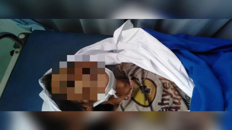 Jasad pria tanpa identitas yang meninggal dunia di RSUD dr Rasidin pada Senin (13/3/2023) sore. (Foto: Dok. Polsek Kuranji)