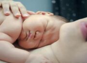 Cerita Miris Balita 6 Bulan di Solok Idap Hidrosefalus