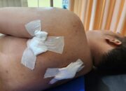 Waduh! Anggota Polisi di Padang Ditusuk Karena Melerai Keributan