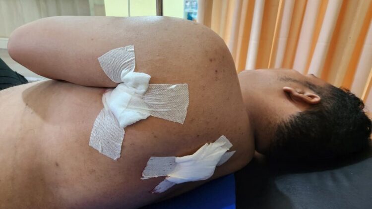 Waduh! Anggota Polisi di Padang Ditusuk Karena Melerai Keributan 1 Anggota polisi ditusuk saat melerai orang berkelahi di Padang. (dok. istimewa)