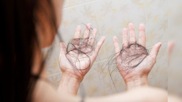 Sering Lelah hingga Rambut Rontok, Bisa jadi Tanda Gejala Autoimun 1 Ilustrasi rambut rontok. (SHUTTERSTOCK/Nalada Nagawasuttama)