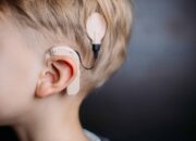 Pemasangan Implan Koklea untuk Pendengaran Lebih Baik