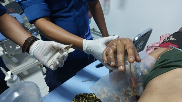 Penyelamatan cincin di jari pasien selesai operasi. (dok. Damkar Padang)