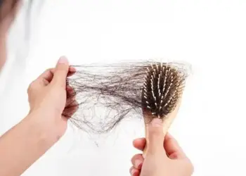 ilustrasi rambut rontok. (dok. istimewa)