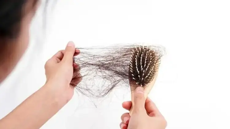 ilustrasi rambut rontok. (dok. istimewa)