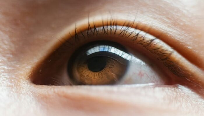 LASIK Mata untuk Atasi Rabun Jauh, Rabun Dekat, dan Silinder